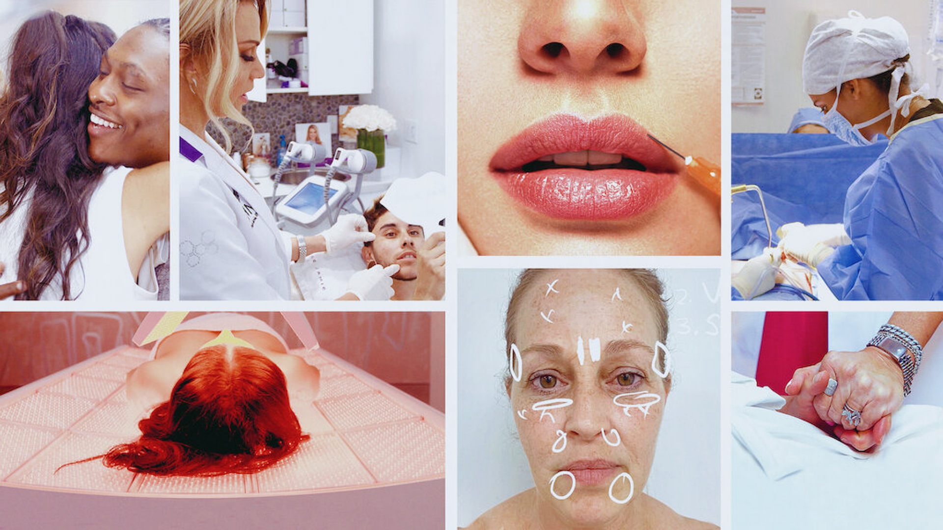 Skin Decision: Before and After 1. Sezon 6. Bölüm